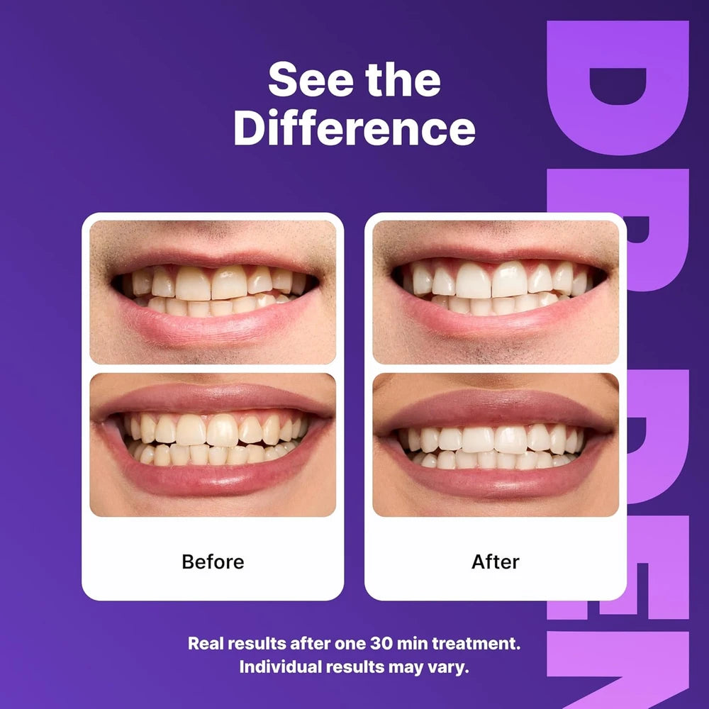 DRDENT Purple Whitening Strips