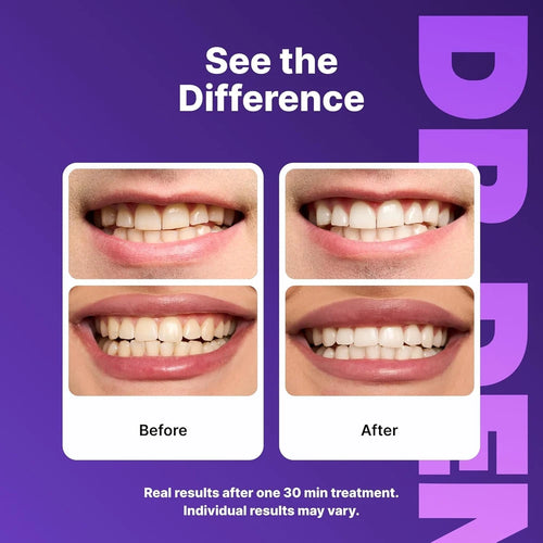 DRDENT Purple Whitening Strips